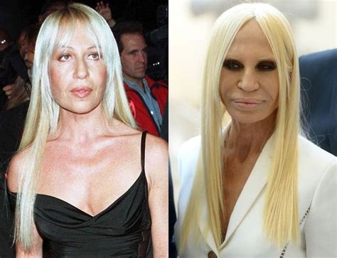 donatella versace before surgeries|donatella versace without plastic surgery.